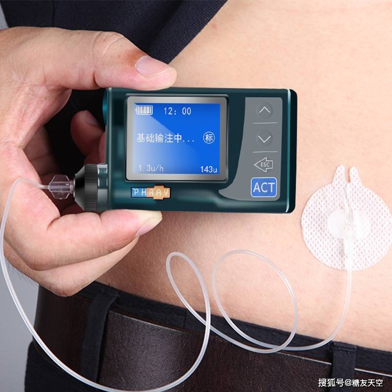 胰岛素泵注射部位感染 5 大原因以及 6 个解决攻略!_手机搜狐网