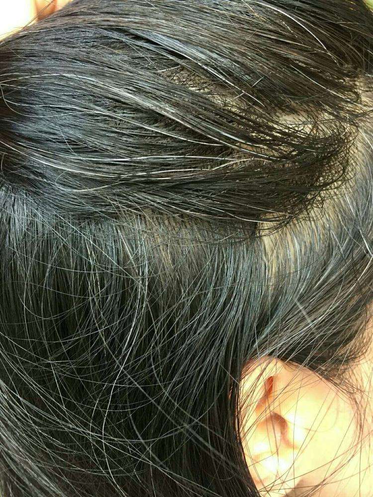 原创掉发发质干枯头发长的慢很可能是身体缺乏这几个元素