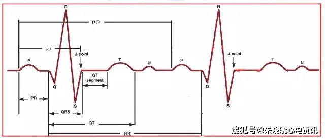 心电图上的那些间期_手机搜狐网
