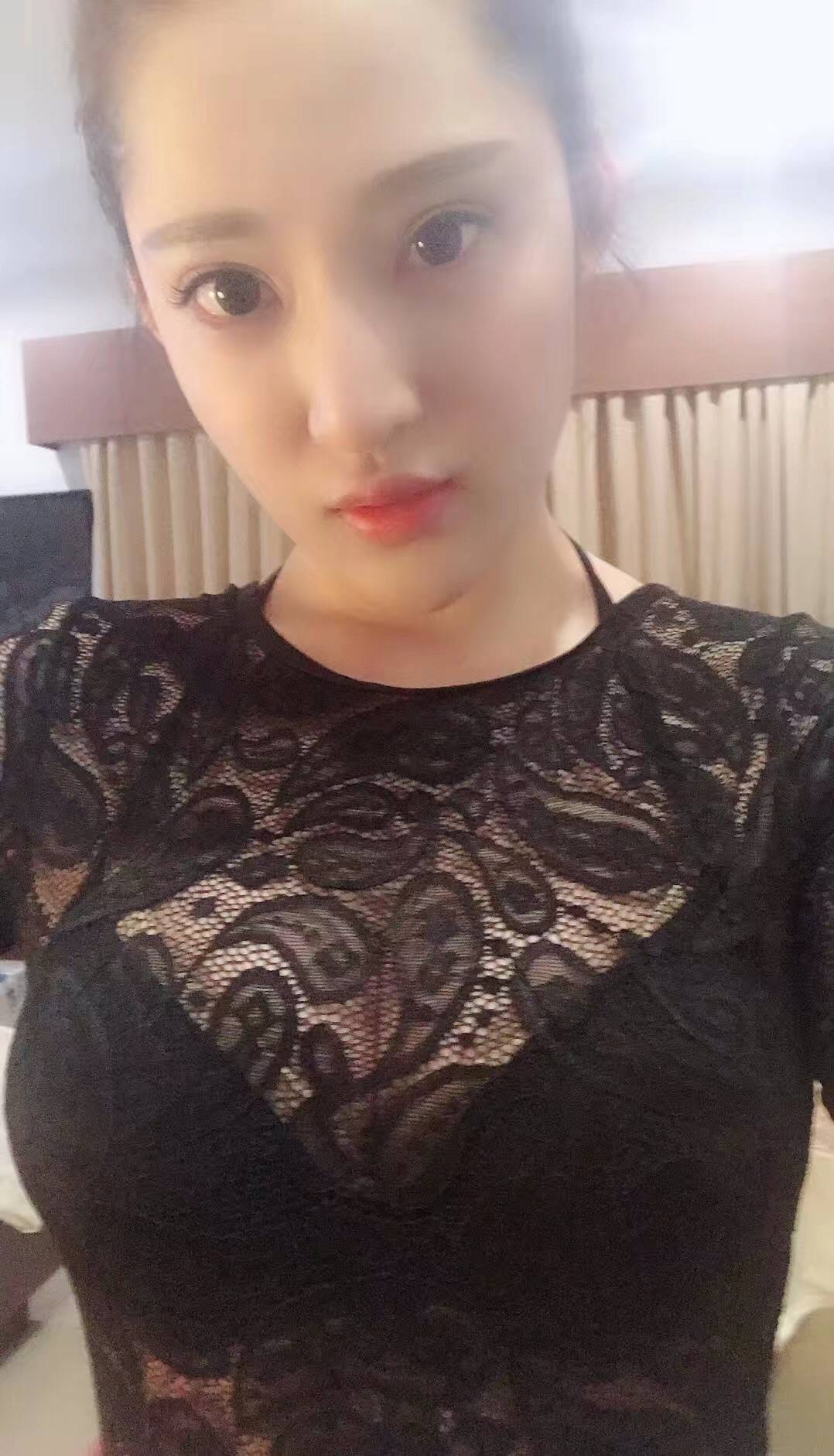 贺天遥:北京自体脂肪隆胸为什么那么受欢迎