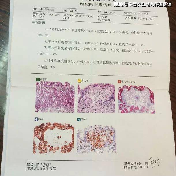 探寻胃镜检查背后的真相：西安地区消费指南