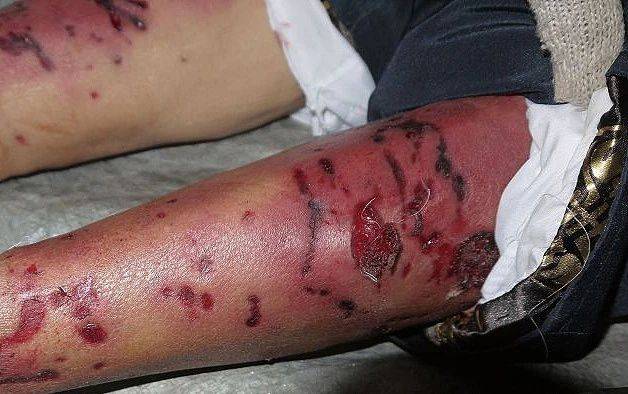 差点步入婚姻殿堂却因养狗而分手