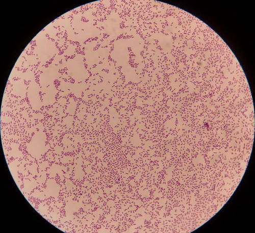 铜绿假单胞菌镜检图片图片