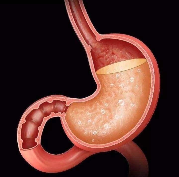 胃酸越多消化功能越好胃酸过多当心胃病来打扰少做这4件事吧