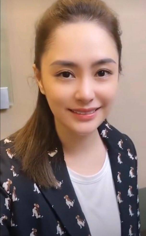 阿娇出院:眉毛的位置很奇怪,伤口还没有完全愈合