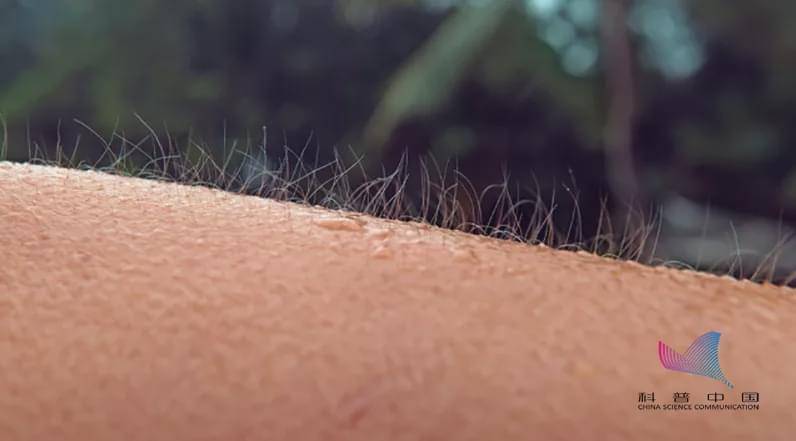 全身鸡皮疙瘩严重(浑身起鸡皮疙瘩都不行) 全身鸡皮疙瘩严重(浑身起鸡皮疙瘩都不行)