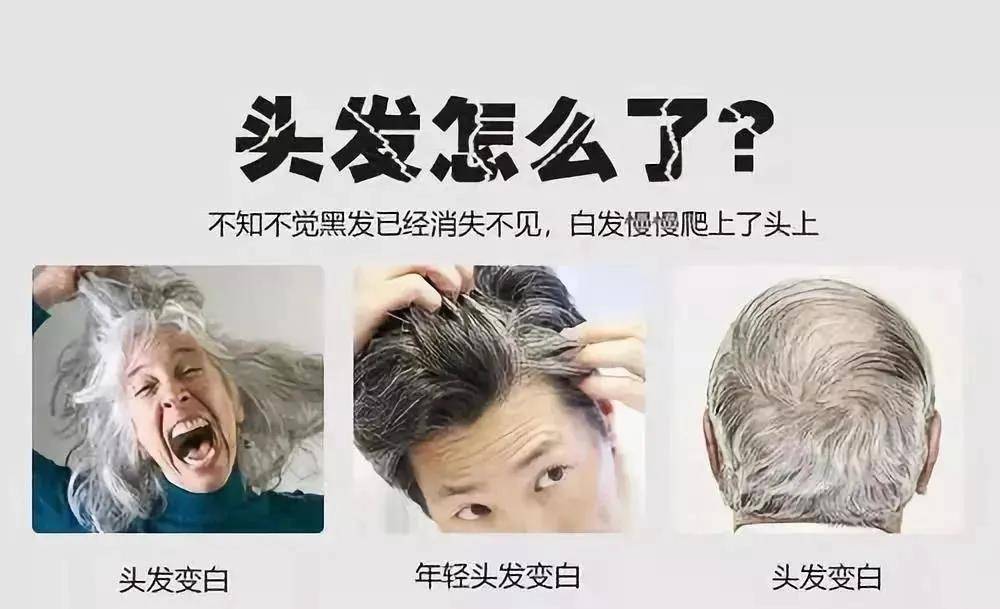 让发质更健康,让发型更漂亮中医讲:头发与肾,肝,脾,肺,心等腑脏组织