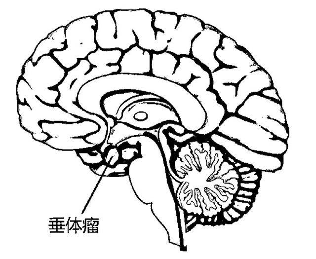 脑垂体简笔画图片