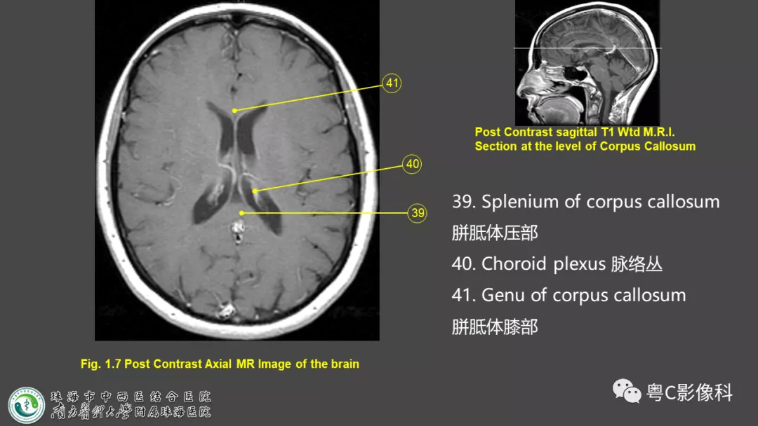 影像解剖,影像技術 :顱腦mri平掃掃描方案