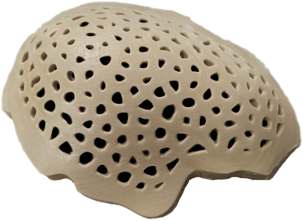 fdm3d打印peek在医疗行业中应用