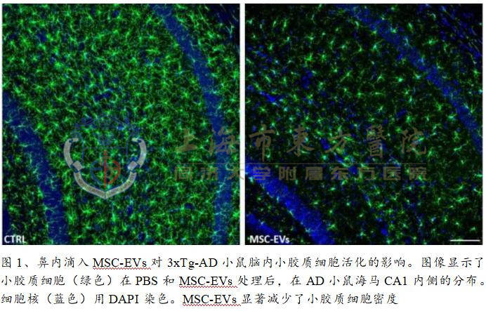 原创老年痴呆症我们如何对抗这个脑健康杀手