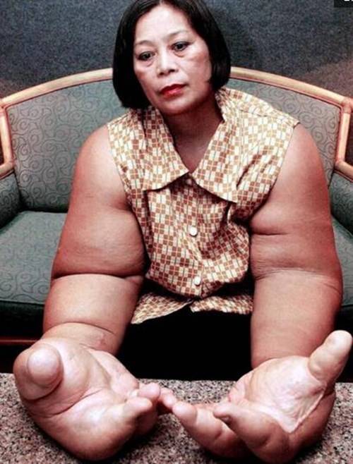 女子双手重达50多斤,像拥有了麒麟臂一样,现实版的绿巨人?_手臂