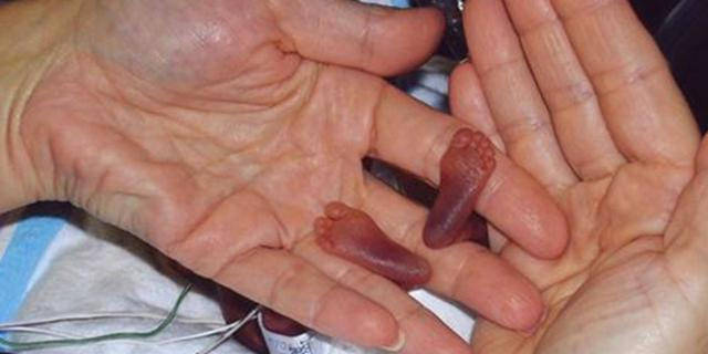 19周的胎儿图片