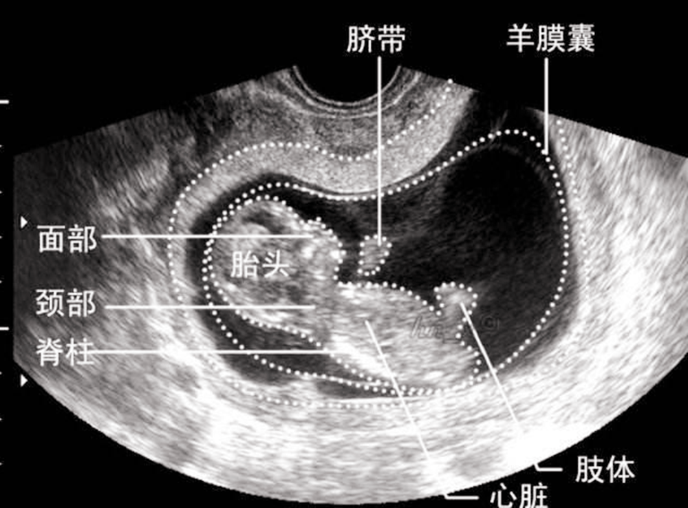 怀孕过了这月