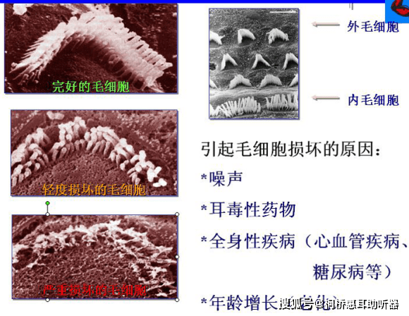 柯桥惠耳助听器 10-17 12:42 订阅 点击查看更多订阅内容 听,是我们