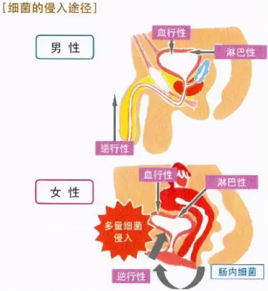 美女尿口图片