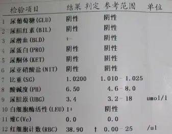 一分鐘教你看懂肝腎功能檢查