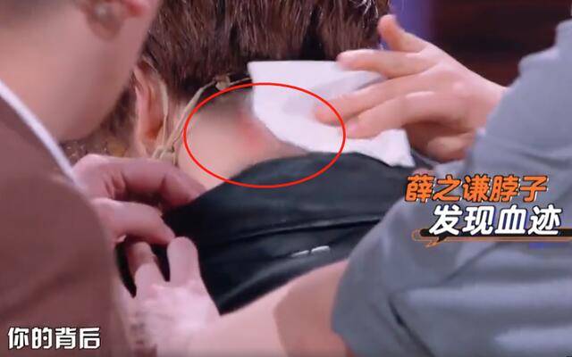 敖犬录节目手掌突被割开!血溅薛之谦脖颈,紧急送医缝合多针