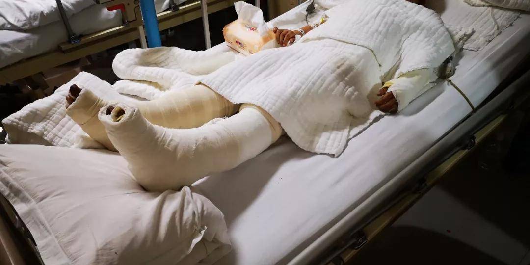 老房成废墟,无情大火致一死两伤