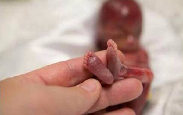 怀孕63天胎儿图片图片