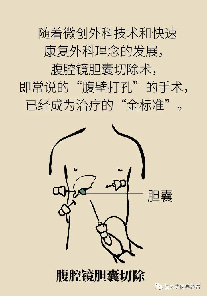 胆囊触诊 来自搜狐网