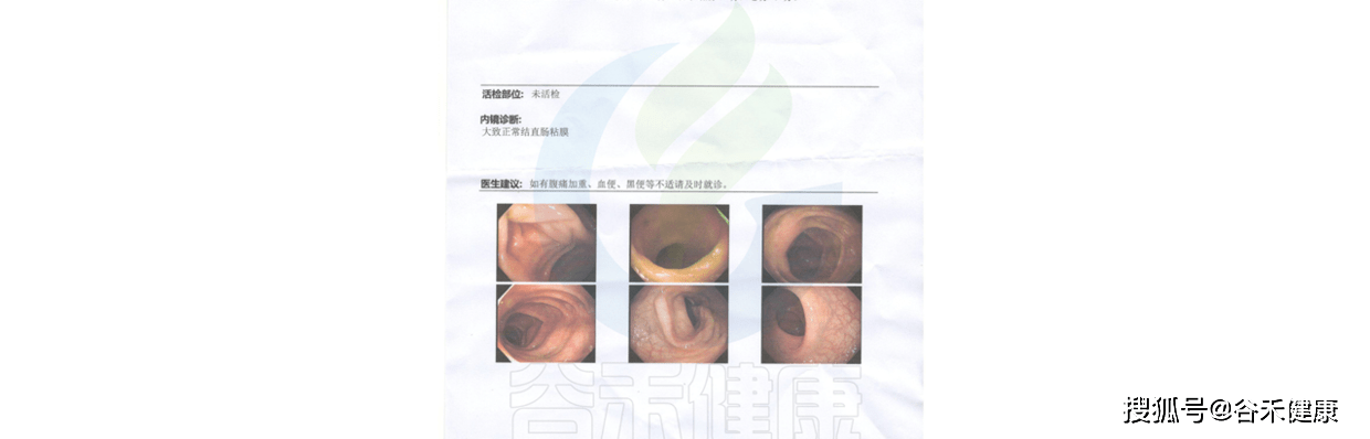 做腸鏡清腸對腸道菌群的影響及後續恢復建議