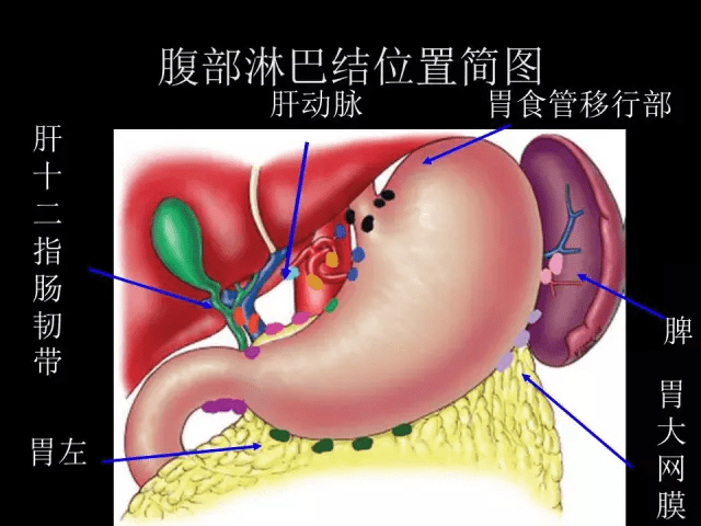 值得收藏的腹部淋巴結影像解剖彩色圖譜