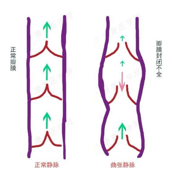 4招帮你缓解小腿酸胀!_手机搜狐网