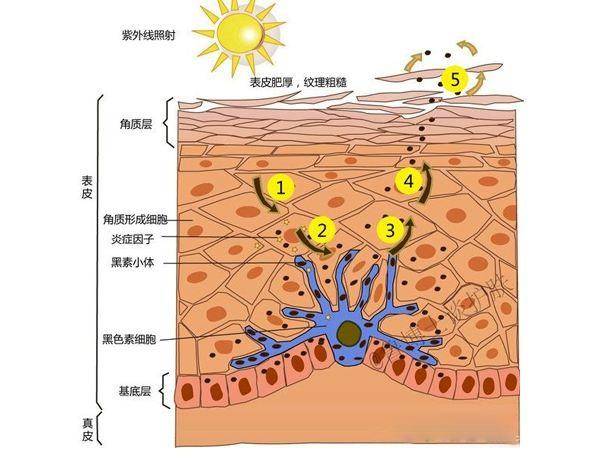 外斑一块内斑十块带你了解斑点形成原因和解决方法