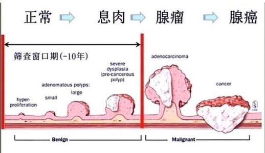 胃息肉的症状表现及检查方法