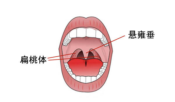 而此時,我們的舌頭和小舌頭,醫學上稱懸雍垂,也會往下壓,從而就會使