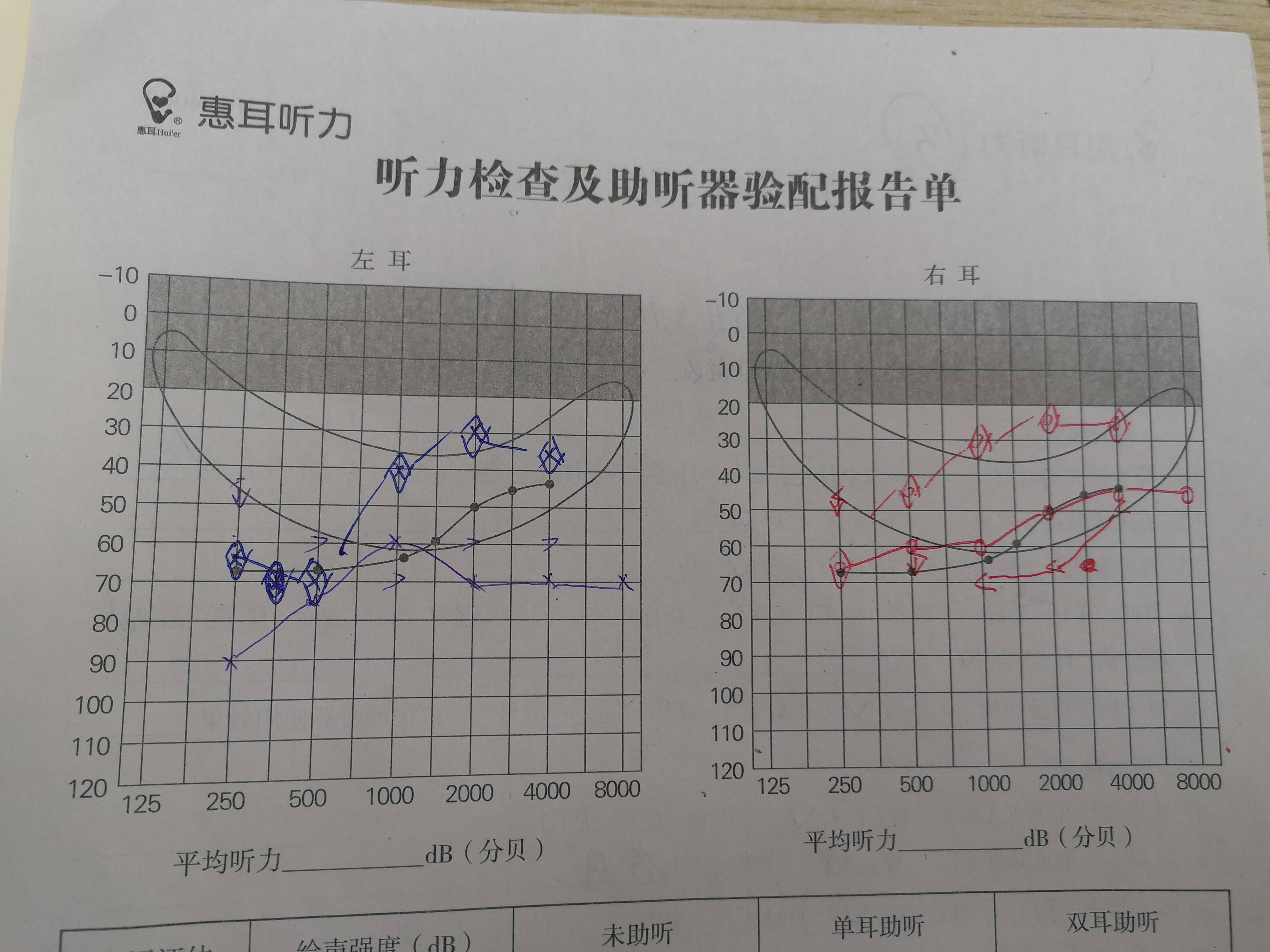 左耳 pta68db hl 属中度聋,语言分辨率:50%;电测听:四,听力检测结果