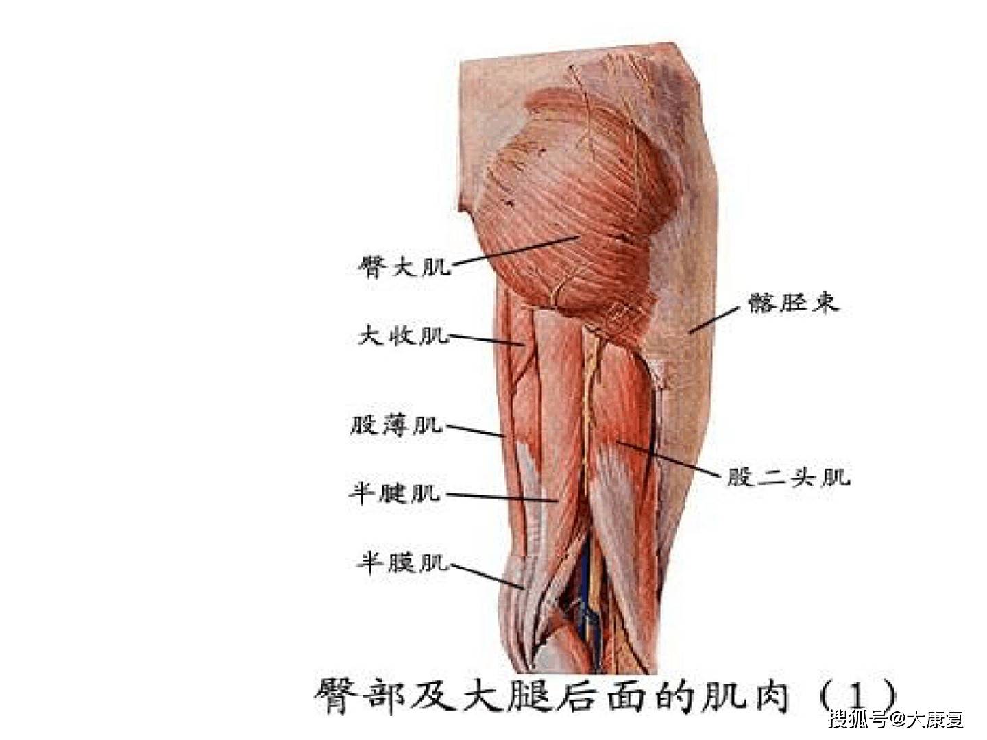 大腿肌腱在哪个位置图片
