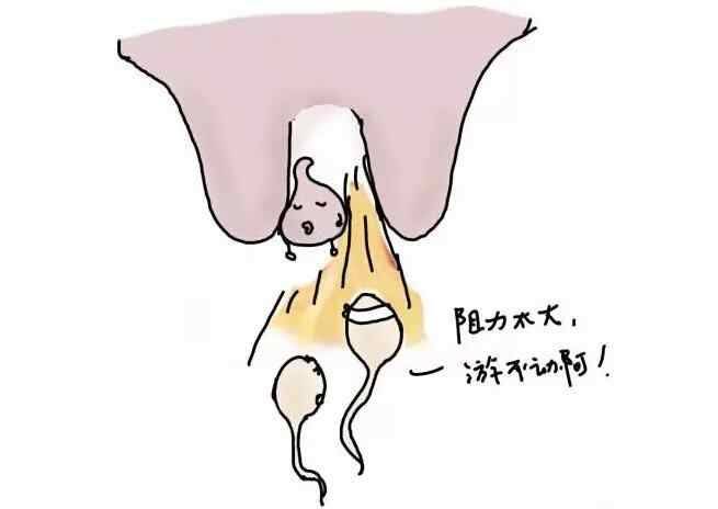 尿道肉阜图片的症状图片