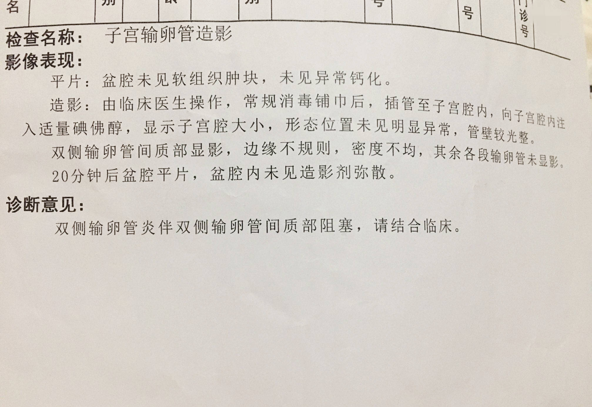 输卵管堵塞的姐妹看一下,或许能用上.