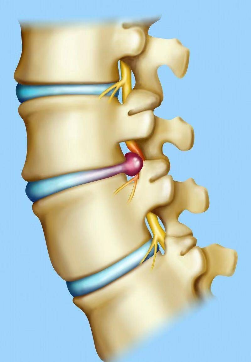 颈椎有病连着肺,腰椎有病连着胃!