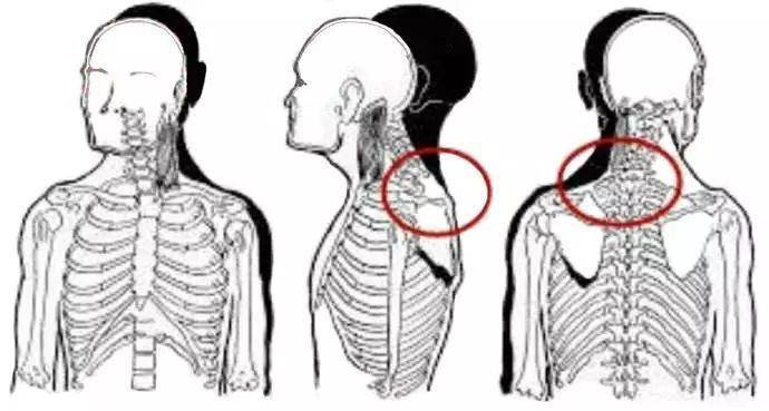 富贵包="夺命包"?