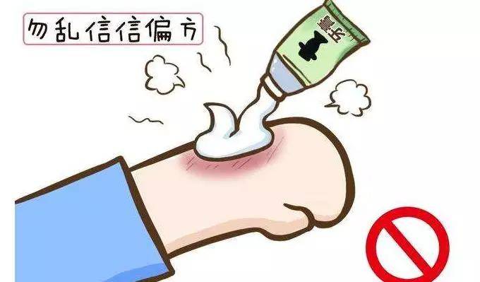 被夹板烫伤怎么办