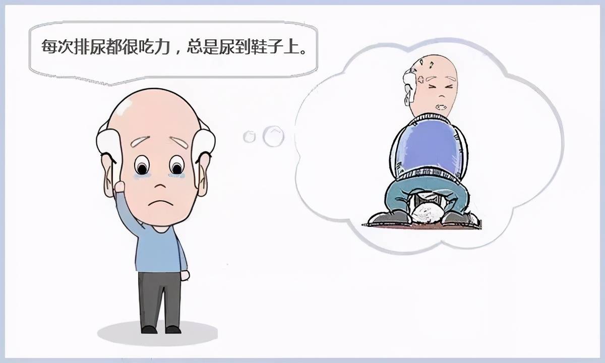 刚开始的时候,只是夜尿次数增多,偶尔伴有尿频,尿急,沈大爷没有重视.