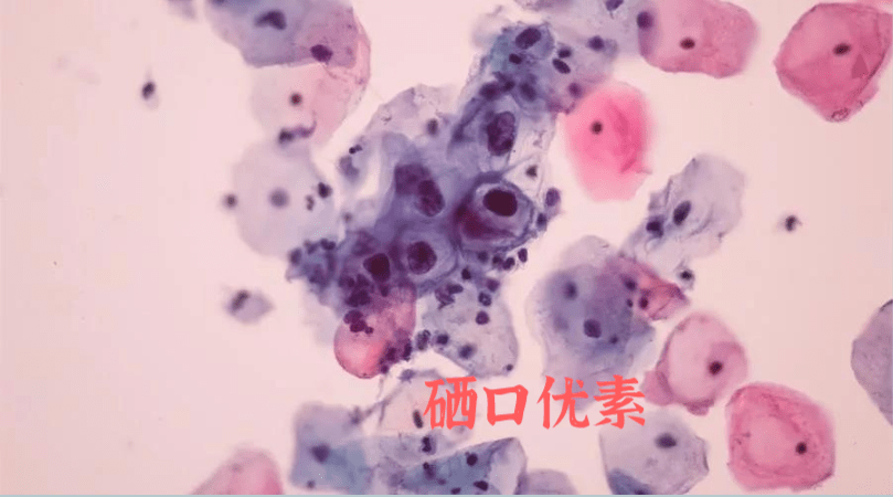 f7450b95388d485e81cc8f55ef21c7ac.png