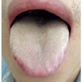 老人口发黑_人口普查(2)