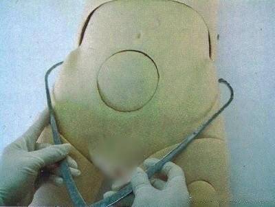 孕期"骨盆测量"一般什么时候做?