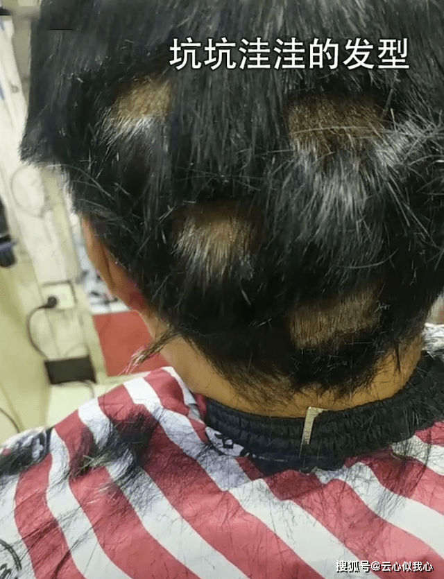 安徽女子花200元理个狗啃头最终气愤报警理发师说可能斑秃