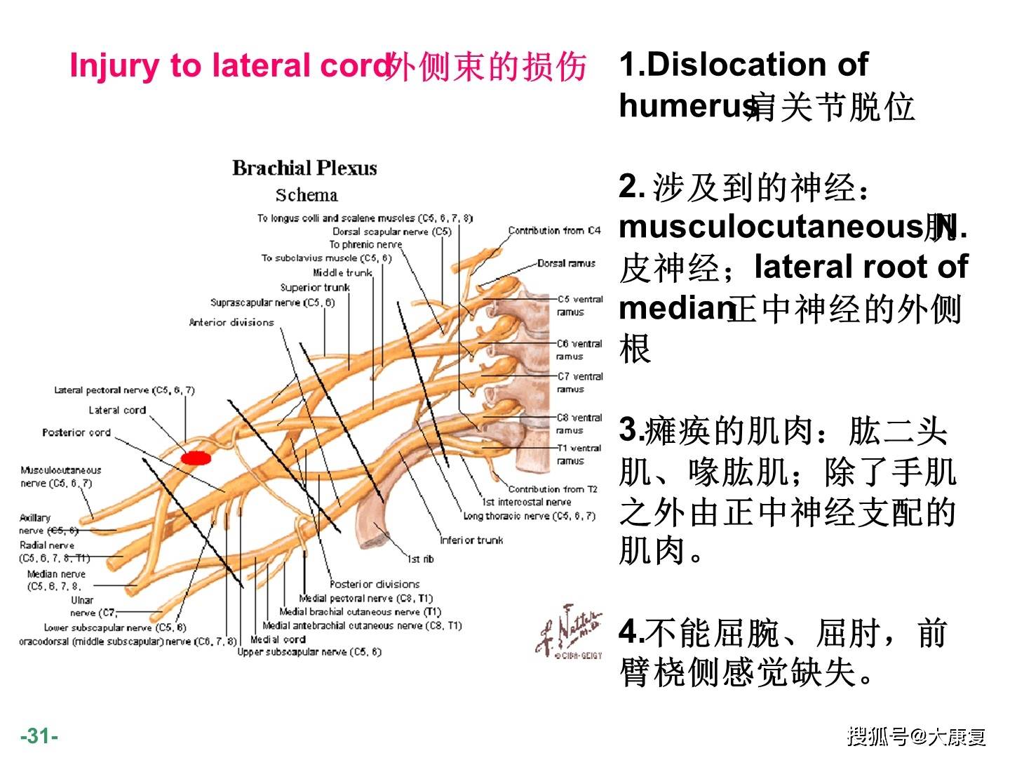 臂丛神经解剖图谱