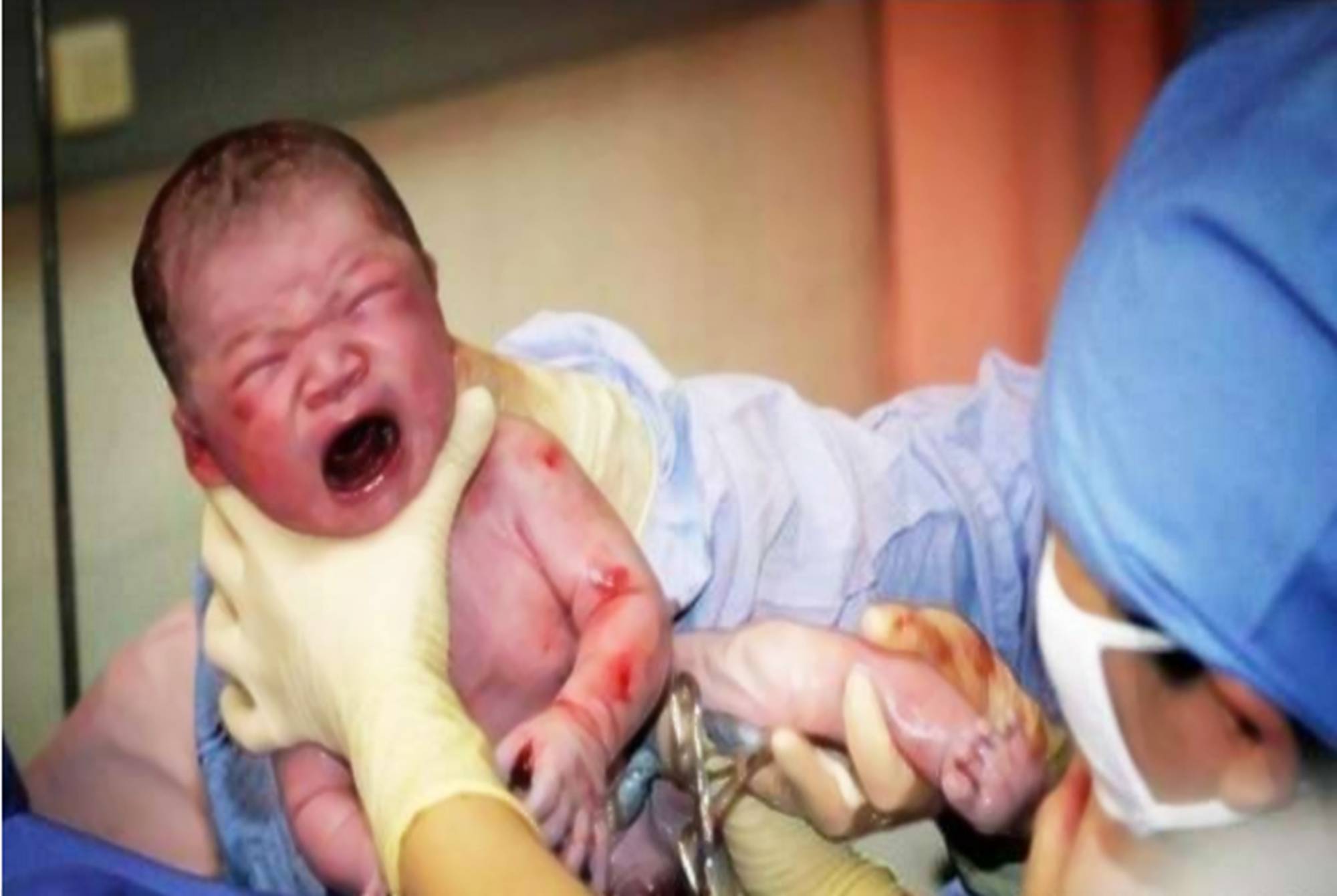 医生，能别用产钳吗”，产妇忍痛换跪姿分娩，为母则刚是大爱_搜狐网