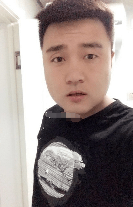 是早年操劳的表现,早年运势不是很好,事业上得不到大的发展,眼角下垂