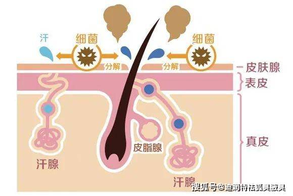 家族遗传狐臭什么原理_狐臭腋下有什么特征图(2)
