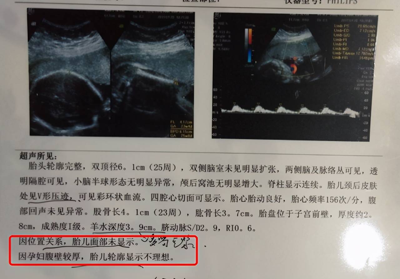 不是因为医生技术差,是这4个原因在作怪