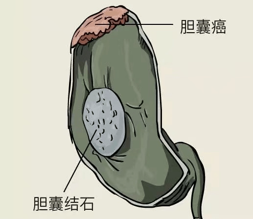 64195a8d5c1846498ad5f982073e09d4.png