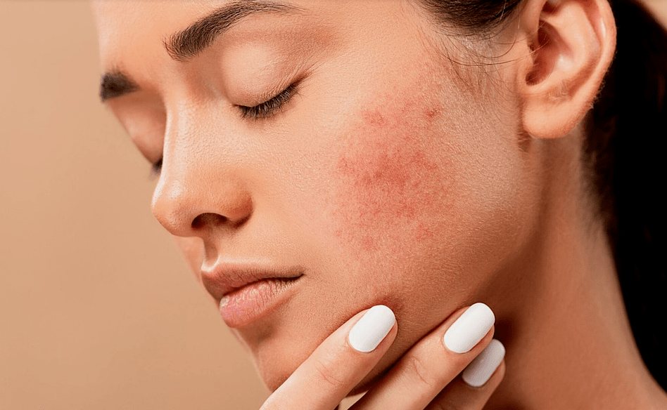 肤什么合成语_畅肤肽药膏主治什么(3)